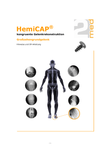 HemiCAP