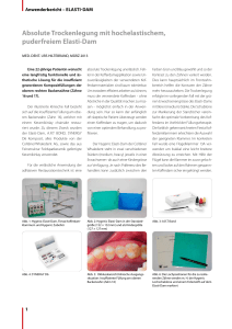 Absolute Trockenlegung mit hochelastischem