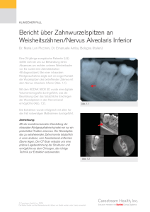 Bericht über Zahnwurzelspitzen an Weisheitszähnen/Nervus