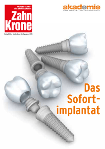 Das Sofort- implantat - Akademie für orale Implantologie