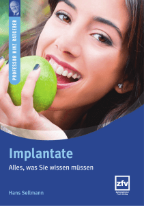 Implantate - Zahnärztlicher Fach