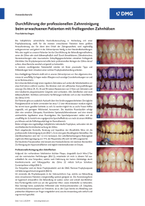 Durchführung der professionellen Zahnreinigung
