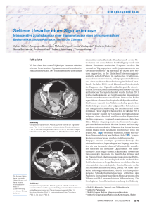 Seltene Ursache einer Sigmastenose
