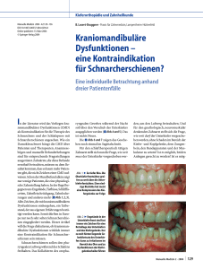 eine Kontraindikation für Schnarcherschienen?