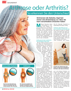 "Arthrose oder Arthritis?" mit Dr. Thomas Schneider - Gelenk