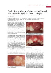 Oralchirurgische Maßnahmen während der kieferorthopädischen