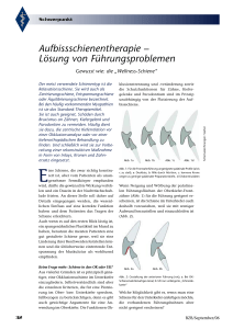 Aufbissschienentherapie – Lösung von Führungsproblemen