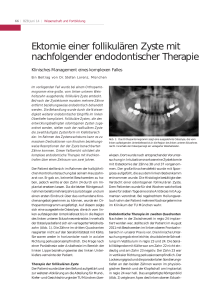 Ektomie einer follikulären Zyste mit nachfolgender endodontischer