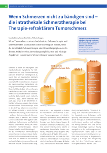 die intrathekale Schmerztherapie bei Therapie