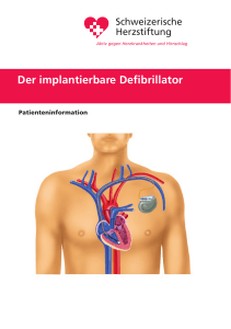 Der implantierbare Defibrillator