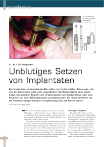 Unblutiges Setzen von Implantaten