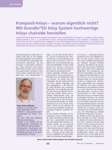 Komposit-Inlays – warum eigentlich nicht? Mit