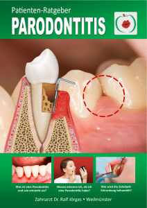 Patienten-Ratgeber - Parodontitis Zahnarzt Weilmünster