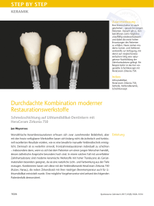 Durchdachte Kombination moderner Restaurationswerkstoffe