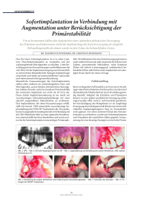 Sofortimplantation in Verbindung mit Augmentation