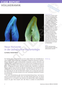 CASE REPORT VOLLKERAMIK Neue Horizonte in