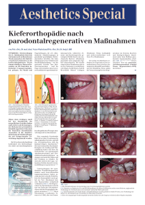 Kieferorthopädie nach parodontalregenerativen Maßnahmen