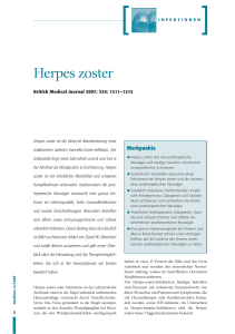 Herpes zoster