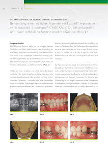 Behandlung einer multiplen Agenese mit Roxolid