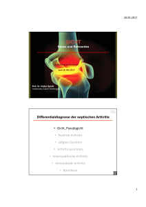 Differentialdiagnose der septischen Arthritis • Gicht, Pseudogicht