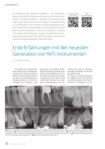 Erste Erfahrungen mit der neuesten Generation von