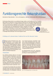 Funktionsgerechte Rekonstruktion