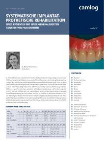 systematische implantat- prothetische rehabilitation