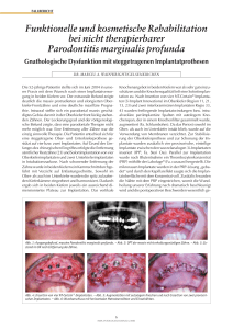 Funktionelle und kosmetische Rehabilitation bei nicht