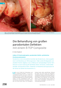 Die Behandlung von großen parodontalen Defekten mit einem ß