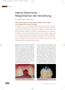 Hybrid-Abutments – Möglichkeiten der Herstellung