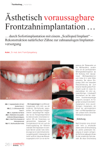 Ästhetisch voraussagbare Frontzahnimplantation …