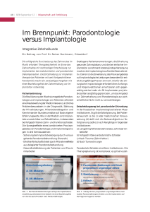 Im Brennpunkt: Parodontologie versus Implantologie