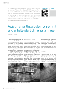 Revision eines Unterkiefermolaren mit lang anhaltender