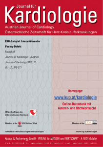 EKG-Beispiel: Intermittierender Pacing-Defekt