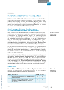 implantatinsertion von vier Miniimplantaten