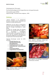 Onkologische Chirurgie - Kantonsspital St.Gallen