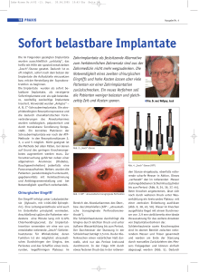 Sofort belastbare Implantate