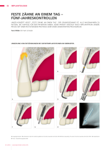 Dental Barometer 01_2012 - Implantologisches Zentrum Zerbst