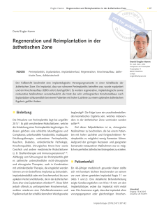 2016 Regeneration und Reimplantation in der ästhetischen Zone