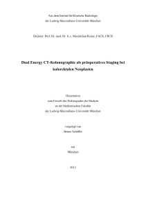 Dual Energy CT-Kolonographie als präoperatives Staging bei