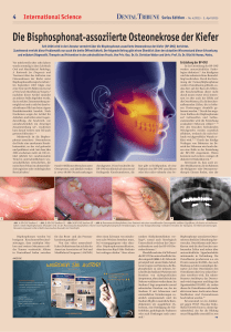 Die Bisphosphonat-assoziierte Osteonekrose der Kiefer
