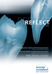 reflect - Ivoclar Vivadent