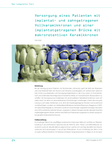 Versorgung eines Patienten mit implantat