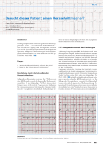 Braucht dieser Patient einen Herzschrittmacher?