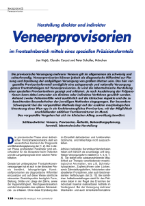 Veneerprovisorien