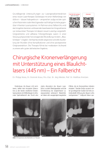 Chirurgische Kronenverlängerung mit