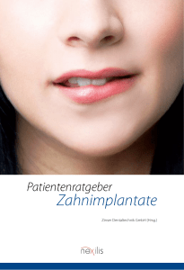 Zahnimplantate - Zinser Dentaltechnik